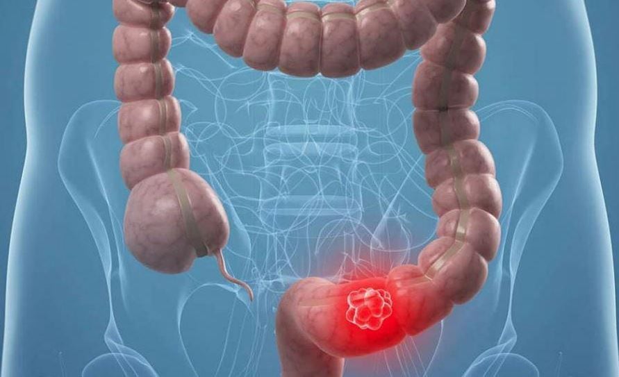 CÁNCER
SALUD IBEROAMÉRICA
TWITTER
